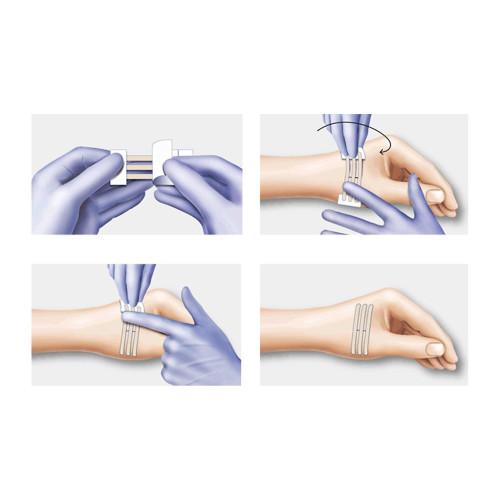 Omnistrip Wundnahtstreifen 12x101 mm