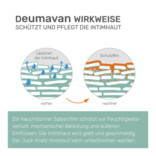 Deumavan Salbe neutral Intimpflege