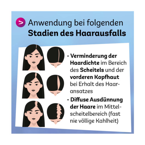 Minoxidil Dexcel 20 mg/ml Spray